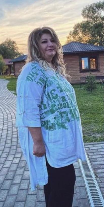 Бариатрическая операция — фотография пациента до операции